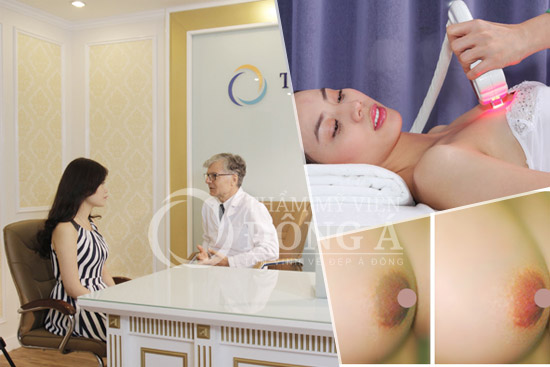 Top 3 cách làm đẹp nhũ hoa đơn giản mà hiệu quả 3