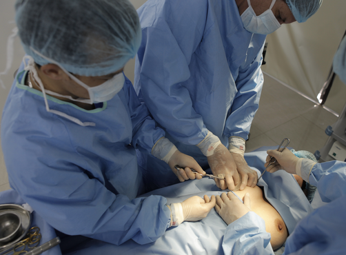 Giải pháp khắc phục ngực quá nhỏ hiệu quả cho từng độ tuổi