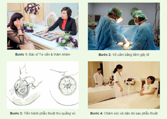 Bật mí ngay cách thu nhỏ quầng thâm nhũ hoa siêu đẹp-4