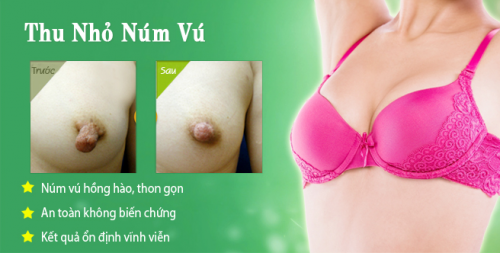 Thu nhỏ đầu ngực đẹp tự nhiên kết quả vĩnh viễn