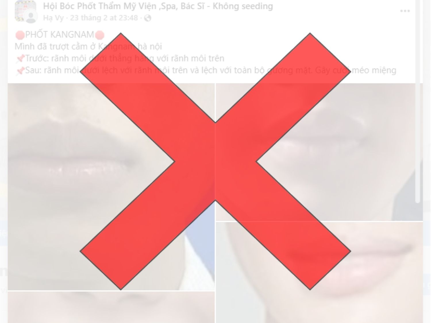 Các thông tin bị biến chứng sau phẫu thuật