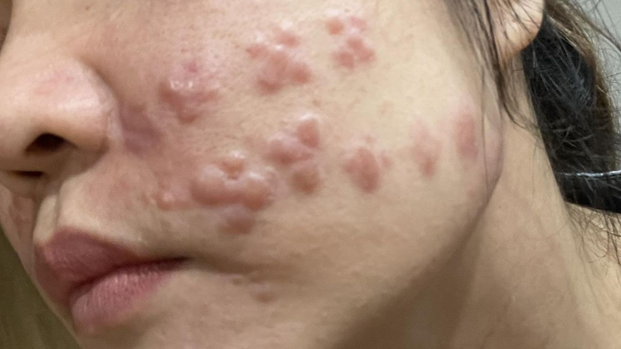 Rủi ro khi tin vào thông tin thẩm mỹ chưa kiểm chứng & Cách xác thực 2026