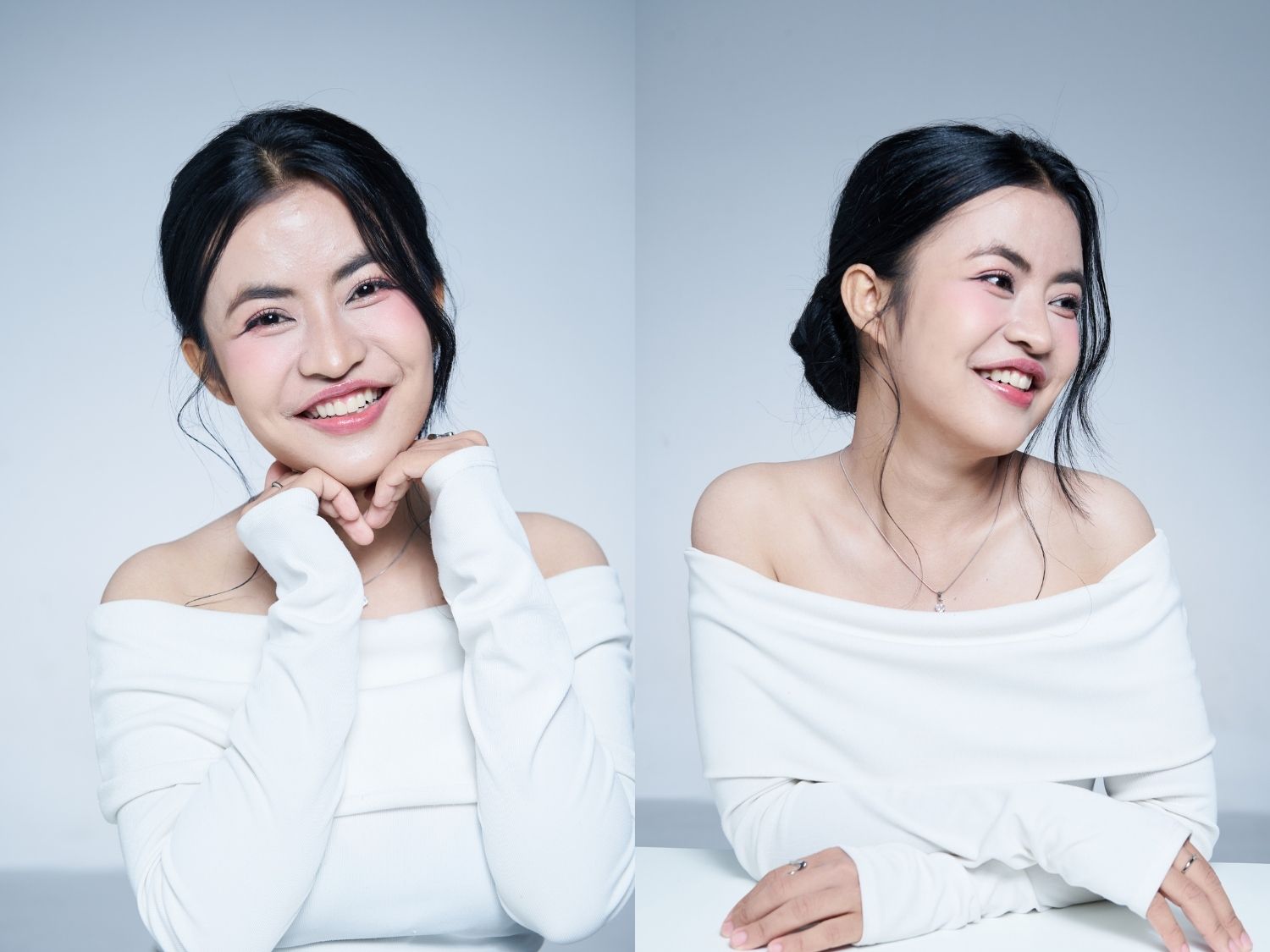 Góc nghiêng hài hòa sau nâng mũi