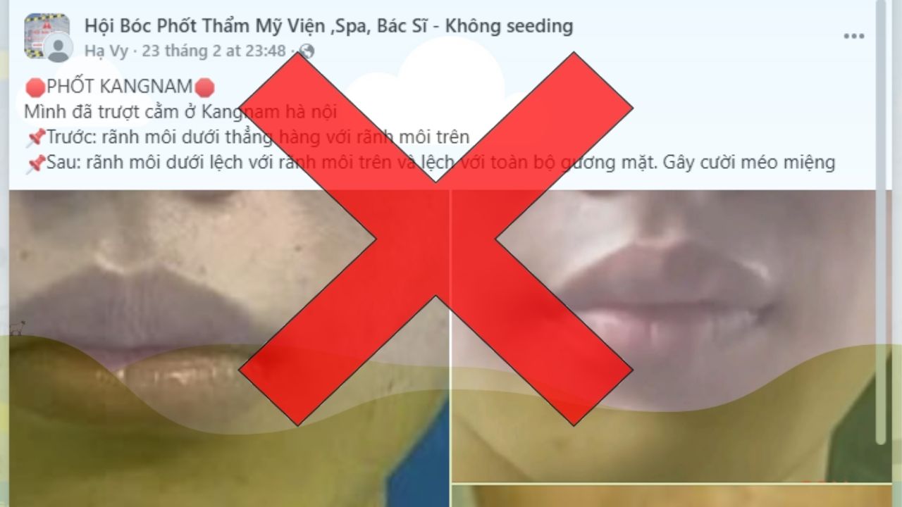 Vì sao trên mạng có nhiều bài bóc phốt Kangnam? Sự thật đằng sau